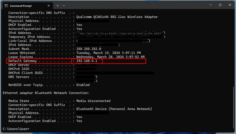 see your current IP address